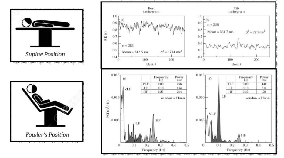자세에 따른 HRV 변화 Tachogram 및 Power Spectral Density