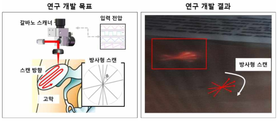 2채널 갈바노미터 스캐너를 사용하여 방사형 스캐닝 기법 연구 및 근적외선 센서에서 촬영한 결과 영상