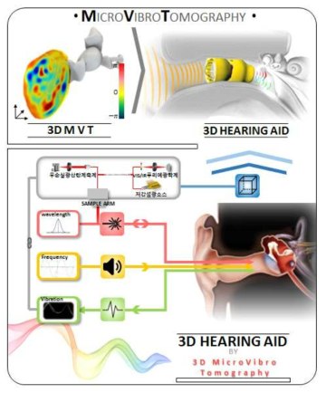 마이크로 바이브로 토모그라피를 이용한 신개념 청력재활기기 개발