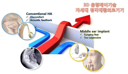 3D 음향제어기술을 통한 차세대 청각재활의료기기 개발