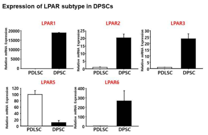 치주인대줄기세포(PDLSC)와 치수줄기세포(DPSC)에서 LPAR 발현 확인