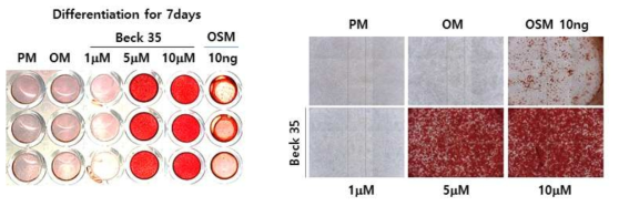 LPAR2 inhibitor(Beck35)와 OncostatinM(OSM)의 치수줄기세포 분화 촉진 효과