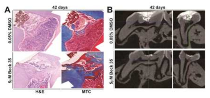 쥐 상아질 재생모델에서 6주 후 HE & MTC 염색(왼쪽) 및 microCT(오른쪽) 결과