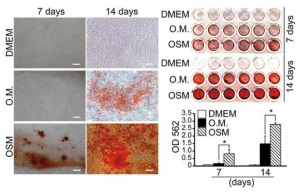 Oncostatin M (OSM)의한 치수줄기세포의 상아질모세포 분화. Alizarin red S 염색 (고배율, 왼쪽; 저배율, 오른쪽)
