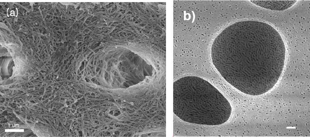 유기물이 제거된 상아질의 전자 현미경 사진(a)과 본 연구진이 최근 개발한 기공 유도법을 통해 만들어진 계층적 다공성 박막(b)