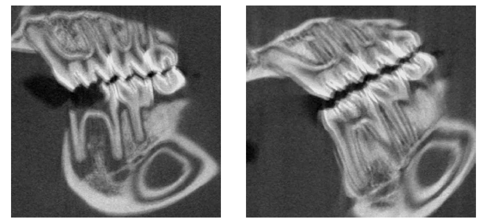 (좌) SD rat에서 periapical inflammation을 유도-3주. (우) 염증을 야기하지는 않는 control rat의 정상적인 apical CT image