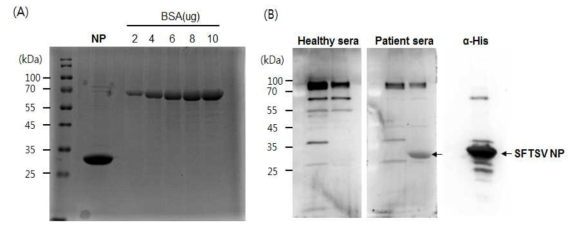 NP 재조합단백질 분리 및 환자혈청에서 발현 확인. (A) Ni-NTA agarose bead를 이용하여 단백질 분리 및 정제. (B) 사람혈청에서 NP 단백질 발현 확인