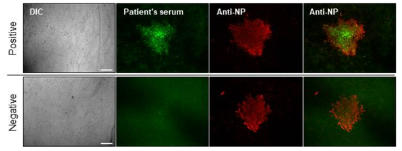 면역형광염색을 통한 SFTSV NP 단백질과 SFTS 환자혈청 반응성 확인