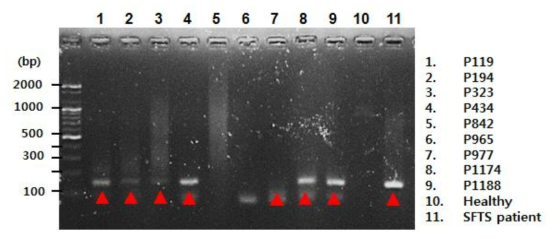 ELISA에서 양성반응을 보인 환자의 혈청에서 RNA를 추출하여 SFTSV S segment 유전자 염기서열에 대한 RT-PCR을 수행함