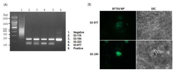 열성질환 환자의 혈청에서 SFTSV 분리 및 배양. (A) 환자 혈청과 함께 배양한 세포의 배양액에서 RNA 추출과 RT-PCR 수행한 결과 SFTSV S segment 유전자가 증폭됨. (B) 바이러스가 감염된 세포에서 면역형광법으로 SFTSV NP 관찰함