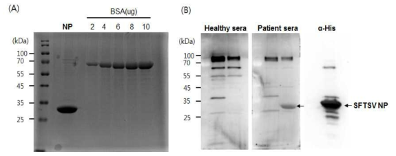 NP 재조합단백질 분리 및 환자혈청에서 발현 확인. (A) Ni-NTA agarose bead 를 이용하여 단백질 분리 및 정제. (B) 사람혈청에서 NP 단백질 발현 확인