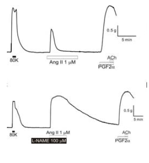 폐동맥 수축과 관련된 김성준 교수팀의 연구결과. Ang II 단독투여 시 수축은 일시적임(상), NOS inhibitor인 L-NAME을 병합 투여 시 지속적인 수축이 발생함 (하)