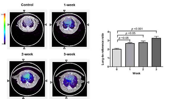 폐동맥고혈압 rat 모델에서 병의 진행에 따라 68Ga-NOTA-MSA의 폐섭취가 점차 증가함 (n=10 per group)