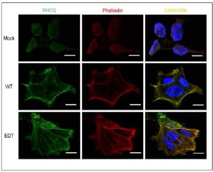 RHOQ RNA editing에 의한 cytoskeletal reorganization