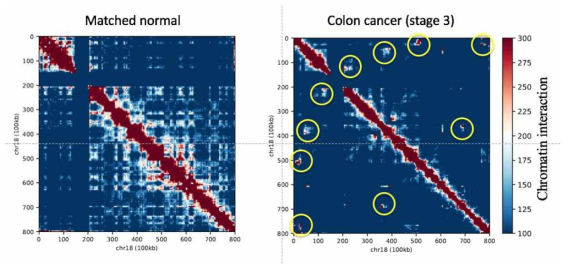 Massive한 암 특이적 cis chromosomal interaction 발굴