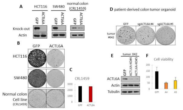 Depletion of the ACTL6A decreased cell growth in colon cancer