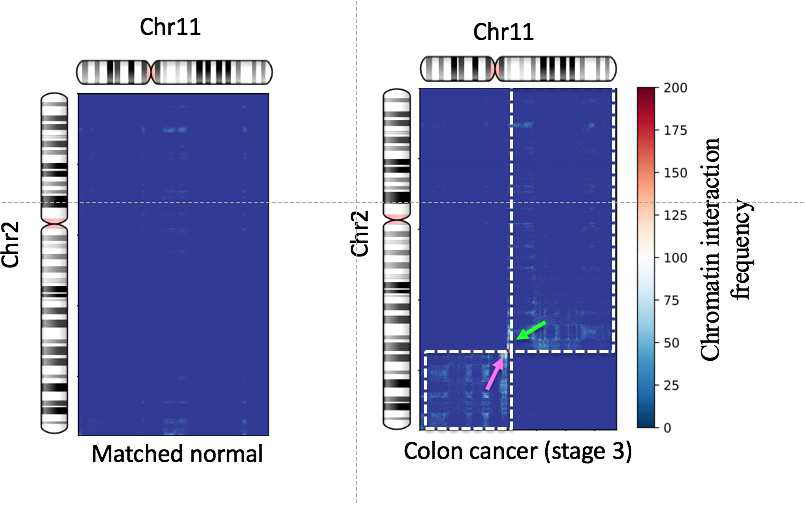 딥러닝 기반 암 특이적 trans-interaction 발굴