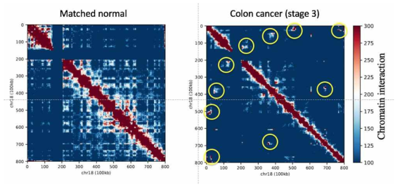 Massive한 암 특이적 cis chromosomal interaction 발굴