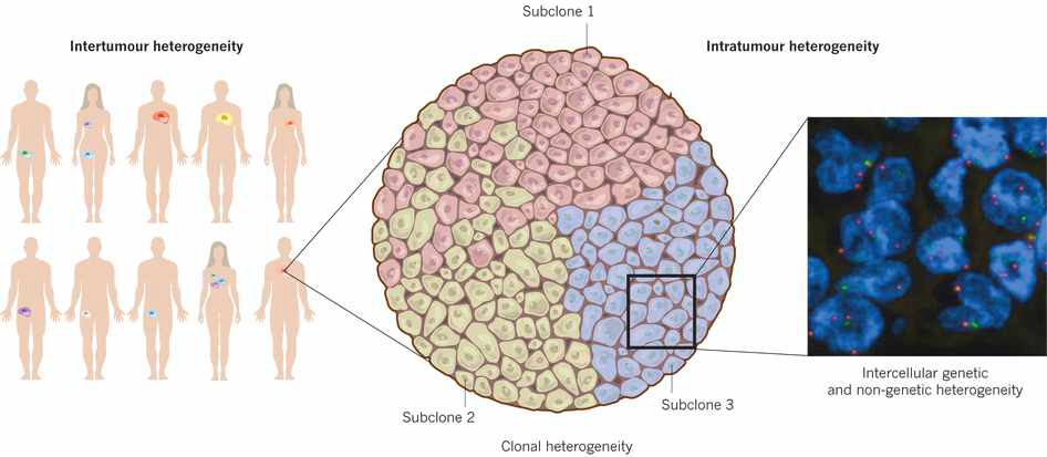 Tumor cell 내부의 종양이질성 (Intratumoral heterogeneity). Genetic 혹은 Non-genetic mechanism이 모두 종양이질성에 기여 (Burrel et al., Nature 2013)