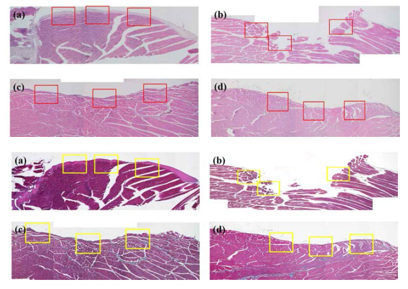 쥐 경골 근육 손실 동물 모델에서 6주 H&E, Masson’s trichrome 염색 결과: (a) 정상군, (b) 근육 손실 only 군, (c) 다공성 마이크로스피어 삽입군 및 (d) 지방유래줄기세포 삽입군