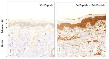 Cu-Peptide에서 Tat-펩티드 사용에 따른 경피약물 흡수효과 (immunohistopathology)