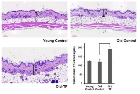 Hapln1에 의한 마우스 피부조직 진피 두께 변화