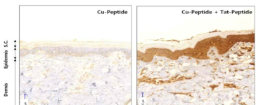 Cu-Peptide에서 Tat 펩티드 사용에 따른 경피 약물흡수 효과(immunohistopathology)