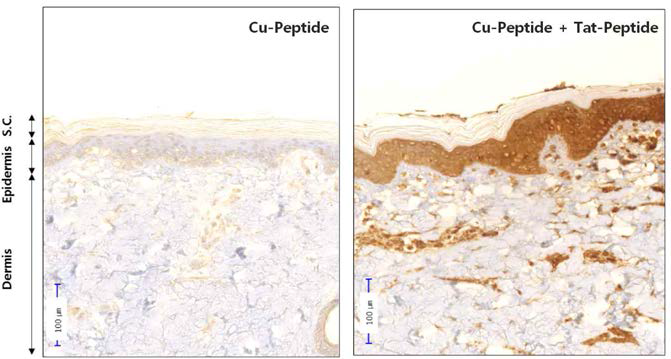 Cu-Peptide에서 Tat 펩티드 사용에 따른 경피 약물흡수 효과(immunohistopathology)