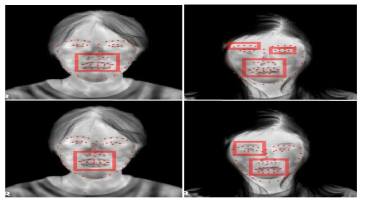 좌) Augmentation 적용 전 얼굴 특징점 추출 결과 우) Augmentation 적용 후 얼굴 특징점 추출 결과