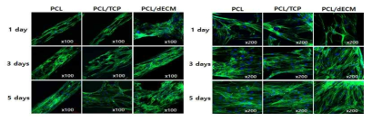 인공지지체의 교차점이 단순 교차로 인공지지체의 well이 직선을 이루고 있는 형태에서의 세포의 배양 및 증식이 이뤄지는 모습을 관찰한 결과. PCL로 제작된 인공지지체보다 기능성 소재인 TCP, dECM이 포함된 인공지지체에서 좀 더 활발한 세포의 증식이 진행되고 있음을 관찰할 수 있었음