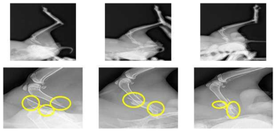 수술1일 후 넓적다리뼈 x-ray 촬영 결과