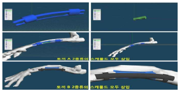 맞춤형 하이브리드 인공지지체 제작을 위한 모델링