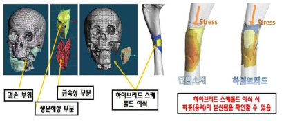 생분해성 소재가 자가 조직 재건을 유도하고, 금속 소재는 조직 재건까지 하중(응력)을 견디는 프레임으로 작용. 금속 소재 인공지지체도 다공성 구조로 제작하여 조직과의 결합을 유도