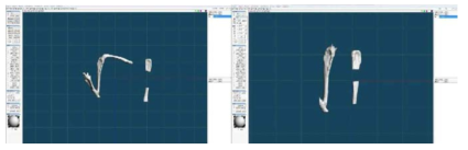 3D 디자인 툴에 개체 삽입 영상. 가공하기 쉽도록 불필요한 부분을 제거 하였으며 결손부위가 있는 뼈에 대해 위치와 축이 보정됨