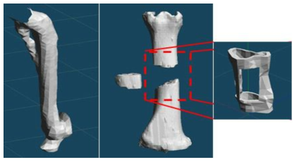 CT측정을 통한 장골뼈 및 파손된 뼈 3D 모델링 및 개념설계 구상