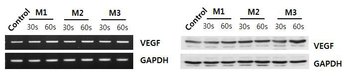 point jet 처리 시, 섬유아세포의 VEGF 발현확인