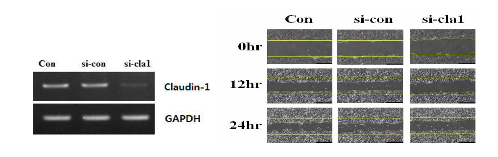 Claudin-1 siRNA transfection한 상피세포의 migration