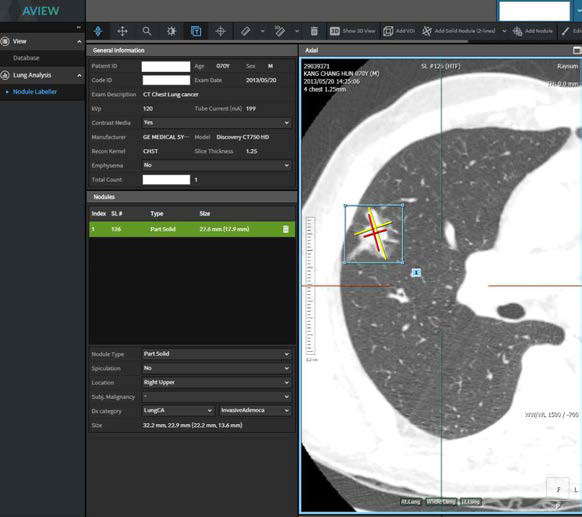 결절 레이블링 소프트웨어 (ROI marking과 다양한 결절 정보, 영상 변수 정보를 함께 저장)