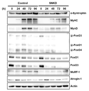 분화 과정 동안 신트로핀 knock-down 세포 내 근육감소증 marker protein 발현 양상