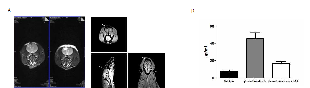 Photo-thrombosis 유도 확인 (A) Magnetic Resonance 장비를 이용한 Photo-thrombosis 유도 부위 확인 및 (B) 뇌혈관 붕괴에 따른 Evans blue leakage 분석