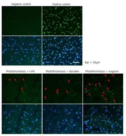 TUNEL Apoptosis assay