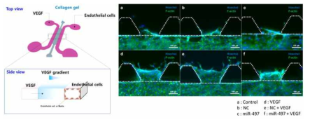3D 마이크로 칩에서 유전자가 탑재된 엑소좀 약물의 혈관신생억제 효능연구