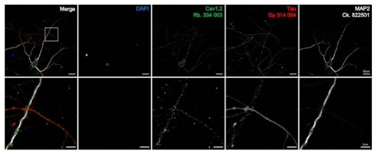 면역염색을 통한 초대배양 신경세포에서 Cav1.2 항체의 검증