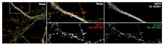 마우스 해마 neuron에서 CaV1.3과 칼슘활동성 포타슘채널 SKCa2 분포패턴