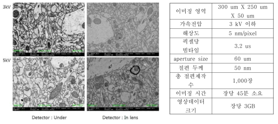 가속전압, 전자신호감지기 유형 선택 테스트 과정과 EM이미징 파라미터. 이미지 크기 8K x 8K pixel, 해상도 5nm/pixel, aperture size 60 um, WD 6.5 mm