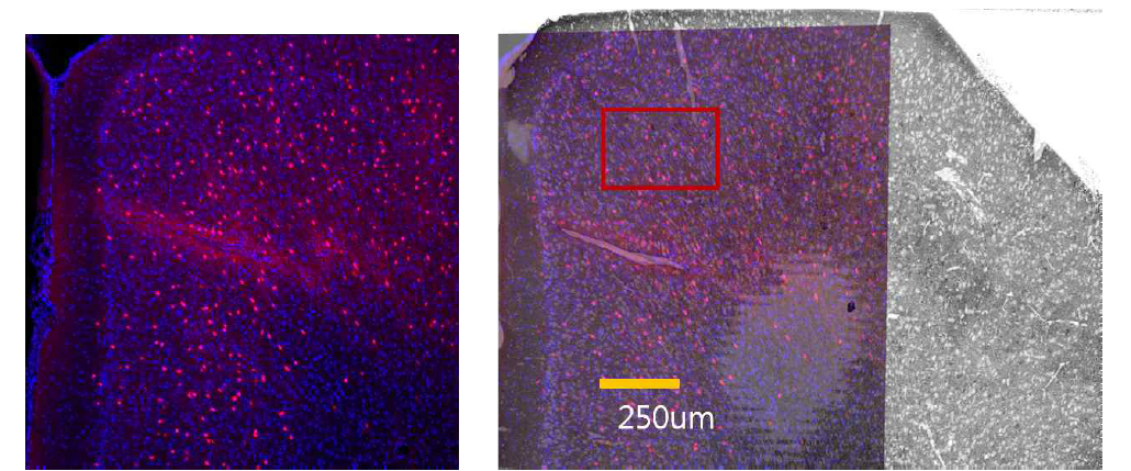 PV+ 인터뉴런에만 선택적으로 형광을 발현하는 PV-ai9 생쥐의 전전두피질. 광학현미경 영상과 전자현미경 저배율 영상 간 연계성 찾음 (ACC 영역). 붉은 색 상자가 고배율 연속영상 데이터를 확보한 영역임