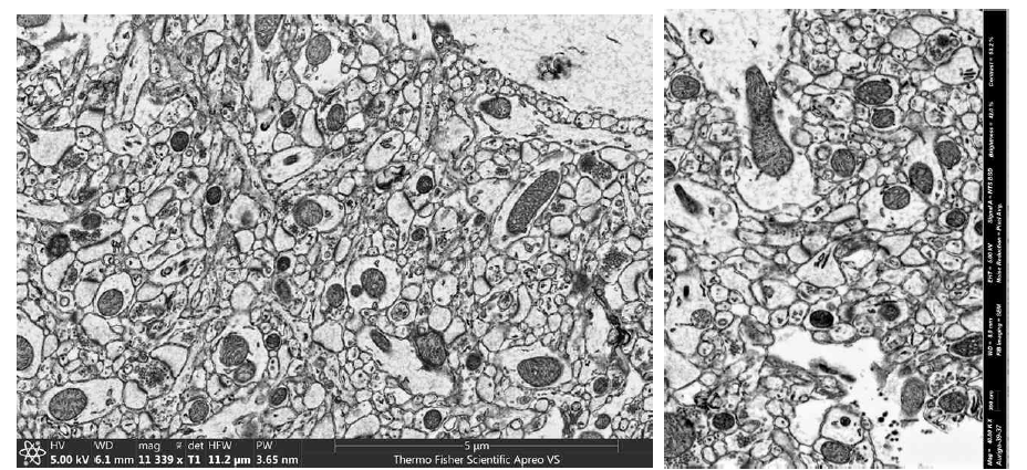 병렬이미징 참여기관에서 획득한 고배율 EM 영상. 5 nm/pixel의 고해상도 이미지로 신경세포 간 시냅스의 연결 관계를 명확히 구분할 수 있음