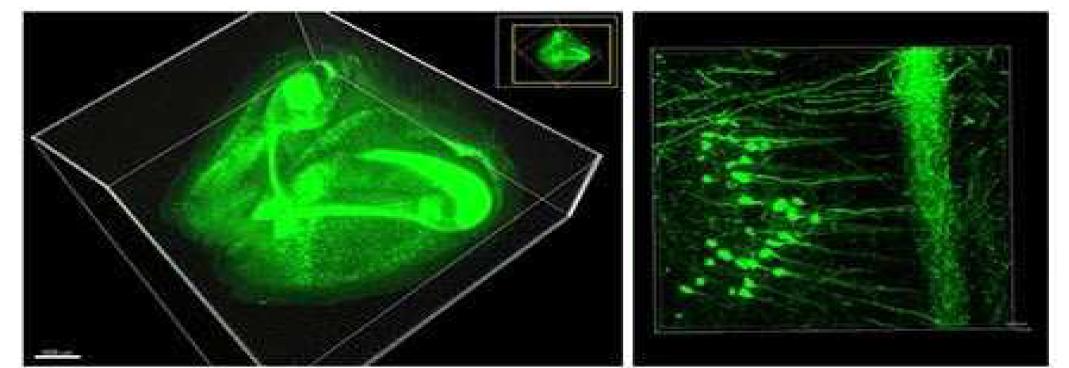 뇌투명화 방법을 이용한 두꺼운 뇌절편에서 신경세포 세부 시냅스 구조 이미징. 100um ~ 2mm 두꺼운 뇌절편 혹은 10um 얇은 뇌절편의 시냅스, axon, dendrite 등을 다수 이미징함으로써 표준화된 프로토콜 확립