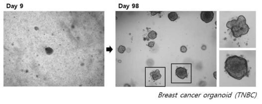 삼중음성 유방암 (TNBC) 환자 유래 오거노이드 배양법 확립