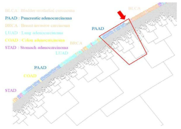 췌장암 원조직 및 오거노이드의 유전자 발현패턴과 TCGA 전사체 데이터베이스와의 클러스터링 비교 분석
